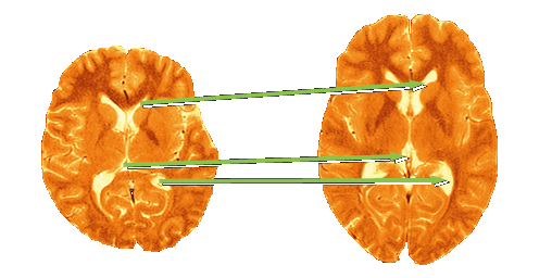 template target image mapping matching