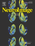 Neuroimage Cover