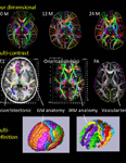 Frontiers Neuroinformatics Figure detail