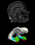 Neuroimage Clin. figure detail